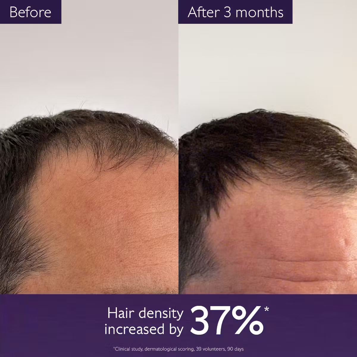 Hair Density Serum