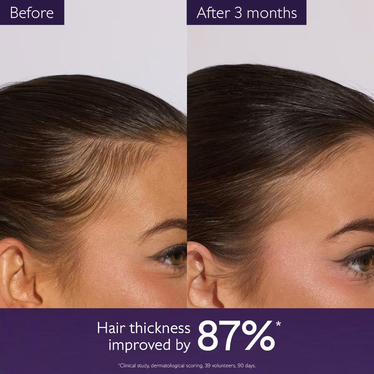 Hair Density Serum