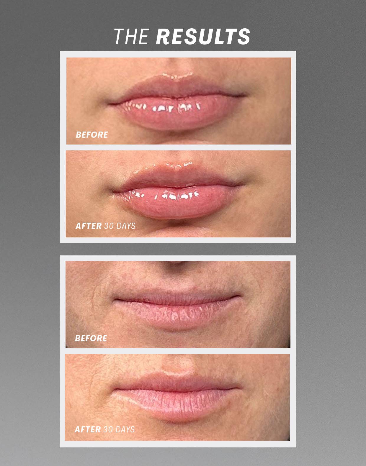 Lip Oasisᵀ Glossy