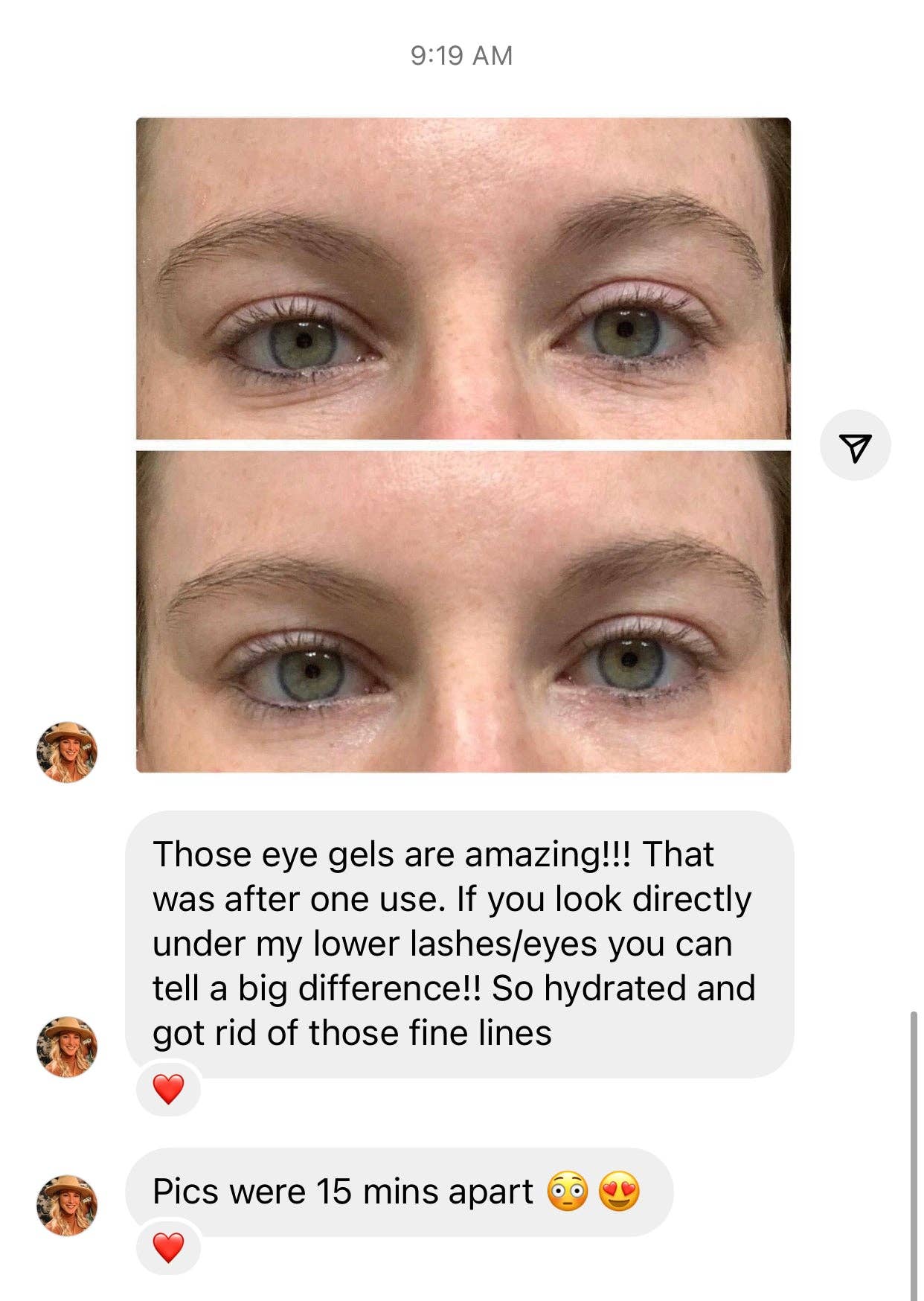 Under Eye Gels